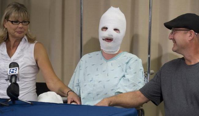 1553148548833525.jpg 燒傷.jpg